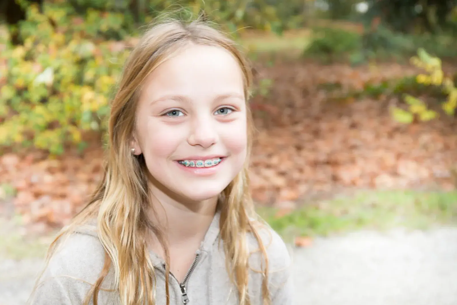 Orthodontic braces and teeth alignment at London Square Dental Calgary
