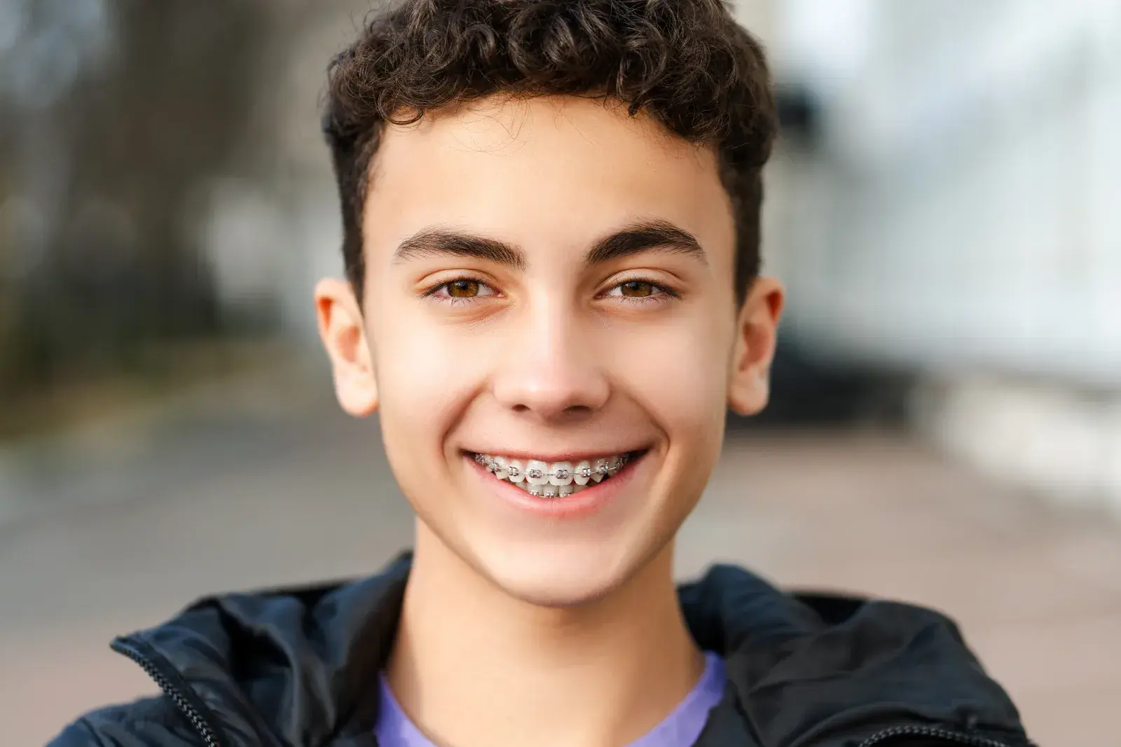 Modern metal braces at London Square Dental